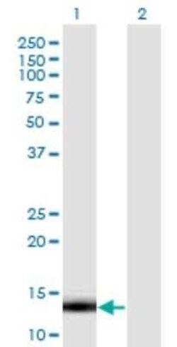 LDOC1 Antibody (3E5), Novus Biologicals 0.1 mg | Buy Online | Novus Biologicals | Fisher Scientific