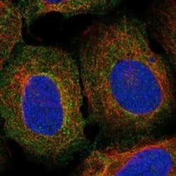 LECT2 Rabbit anti-Human, Polyclonal, Novus Biologicals 100 &mu;g; Unconjugated:Antibodies,
