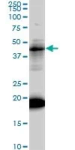 LEF1 Antibody (3H5), Novus Biologicals 0.1 mg | Buy Online | Novus Biologicals | Fisher Scientific