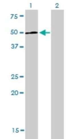 LEF1 Antibody (3H5), Novus Biologicals 0.1 mg | Buy Online | Novus Biologicals | Fisher Scientific