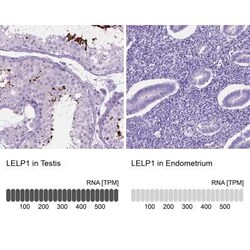 LELP1 Antibody, Novus Biologicals 25 &mu;L, Unconjugated:Antibodies, Polyclonal
