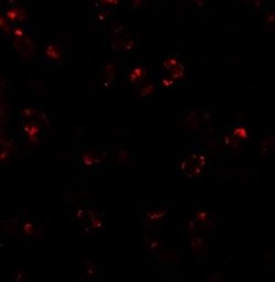 LEMD2 Antibody - BSA Free, Novus Biologicals 0.1 mg; Unconjugated:Antibodies,