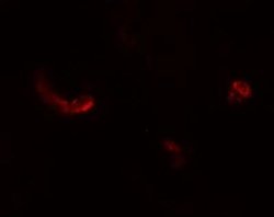 LEMD3 Antibody - BSA Free, Novus Biologicals 0.1 mg | Buy Online | Novus Biologicals | Fisher Scientific