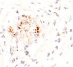 LEMD3 Antibody - BSA Free, Novus Biologicals 0.1 mg | Buy Online | Novus Biologicals | Fisher Scientific