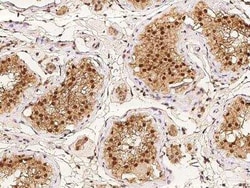 LEMD3 Antibody, Novus Biologicals:Antibodies:Primary Antibodies