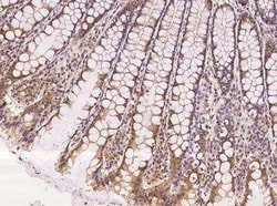 LEMD3 Antibody, Novus Biologicals:Antibodies:Primary Antibodies