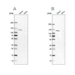LEMD3 Antibody, Novus Biologicals 0.1 mL; Unconjugated:Antibodies, Polyclonal