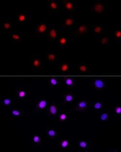 LEO1 Rabbit anti-Human, Mouse, Rat, Polyclonal, Novus Biologicals 100 &mu;g | Buy Online | Novus Biologicals | Fisher Scientific