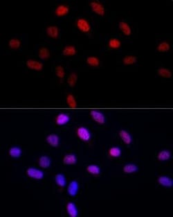 LEO1 Rabbit anti-Human, Mouse, Rat, Polyclonal, Novus Biologicals 100 &mu;g | Buy Online | Novus Biologicals | Fisher Scientific