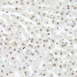 LEO1 Rabbit anti-Human, Mouse, Rat, Polyclonal, Novus Biologicals 100 &mu;g | Buy Online | Novus Biologicals | Fisher Scientific