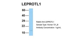 LEPROTL1 Rabbit anti-Human, Polyclonal, Novus Biologicals 0.1 mL | Buy Online | Novus Biologicals | Fisher Scientific