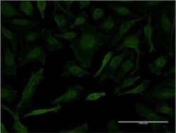 LETM1 Antibody (2C6), Novus Biologicals 0.1 mg | Buy Online | Novus Biologicals | Fisher Scientific