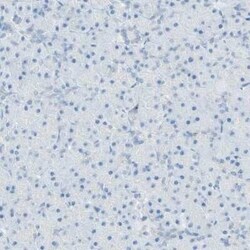 LETM1 Antibody, Novus Biologicals 25 &mu;L | Buy Online | Novus Biologicals | Fisher Scientific