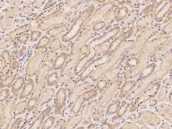 LETMD1 Antibody, Novus Biologicals:Antibodies:Primary Antibodies