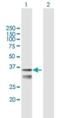 LETMD1 Antibody, Novus Biologicals 0.05 mg | Buy Online | Novus Biologicals | Fisher Scientific
