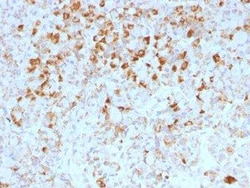 LH beta Antibody (LHb/1214), Novus Biologicals 0.1mg; Unlabeled:Antibodies,