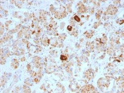 LH beta Antibody (SPM103), Novus Biologicals 0.02mg; Unlabeled:Antibodies,