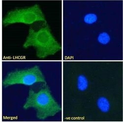 LHR Antibody, Novus Biologicals LHR Antibody; Unconjugated; 0.1 mg:Antibodies,