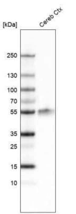 LHX2 Antibody (CL6137), Novus Biologicals 100&mu;L:Antikroppar