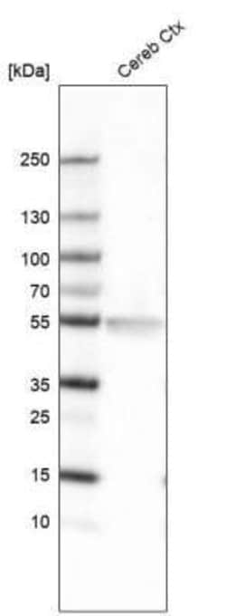 LHX2 Antibody (CL6137), Novus Biologicals 100&mu;L:Antikroppar
