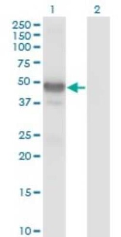 Novus Biologicals LHX2 Antibody (1E6), Novus Biologicals 0.1 mg | Buy Online | Novus Biologicals&trade; | Fisher Scientific