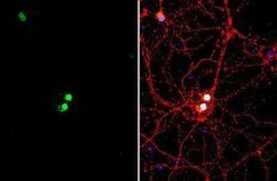 LHX3 Antibody, Novus Biologicals 100 &mu;g | Buy Online | Novus Biologicals | Fisher Scientific