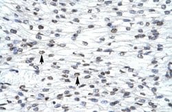 LHX3 Rabbit anti-Human, Polyclonal, Novus Biologicals 0.1ml; Unconjugated:Antibodies,