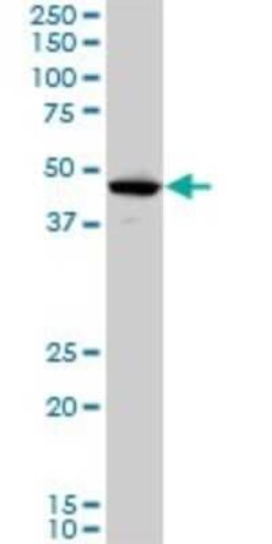 LHX5 Antibody (2B11), Novus Biologicals 0.1 mg | Buy Online | Novus Biologicals | Fisher Scientific