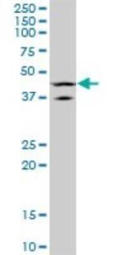 LHX5 Antibody (2B11), Novus Biologicals 0.1 mg | Buy Online | Novus Biologicals | Fisher Scientific