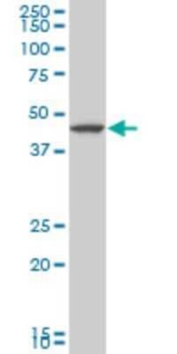 LHX5 Antibody (2B11), Novus Biologicals 0.1 mg | Buy Online | Novus Biologicals | Fisher Scientific