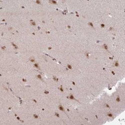 LHX5 Antibody, Novus Biologicals:Antibodies:Primary Antibodies