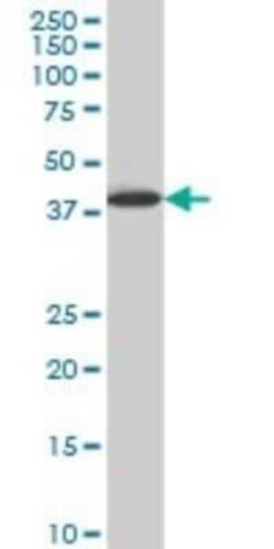 LHX6 Antibody (3E8), Novus Biologicals 0.1 mg | Buy Online | Novus Biologicals | Fisher Scientific