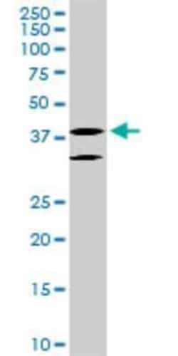 LHX6 Antibody (3E8), Novus Biologicals 0.1 mg | Buy Online | Novus Biologicals | Fisher Scientific
