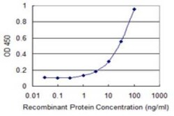 LHX9 Antibody (4C7), Novus Biologicals 0.1 mg | Buy Online | Novus Biologicals | Fisher Scientific