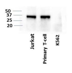 LIF Antibody (39N7D10) - Azide and BSA Free, Novus Biologicals 0.1 mg;
