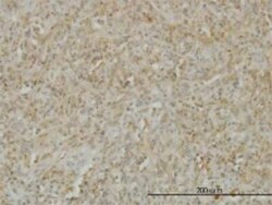 LIGHT/TNFSF14 Antibody (4E3), Novus Biologicals 100 &mu;g | Buy Online | Novus Biologicals | Fisher Scientific