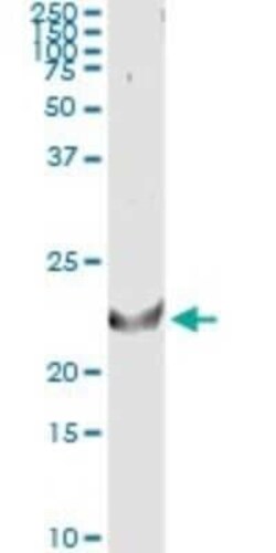 LIGHT/TNFSF14 Antibody (4E3), Novus Biologicals 100 &mu;g | Buy Online | Novus Biologicals | Fisher Scientific