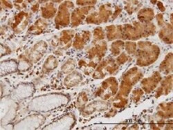 LIM Kinase 1 Antibody (1A8), Novus Biologicals 100 &mu;g | Buy Online | Novus Biologicals | Fisher Scientific