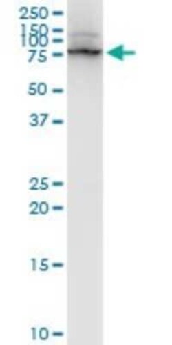 LIM Kinase 1 Antibody (1A8), Novus Biologicals 100 &mu;g | Buy Online | Novus Biologicals | Fisher Scientific