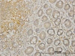 LIM Kinase 1 Antibody (1B2), Novus Biologicals 0.05 mg | Buy Online | Novus Biologicals | Fisher Scientific