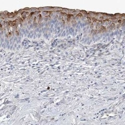 LIM Kinase 1 Antibody, Novus Biologicals:Antibodies:Primary Antibodies