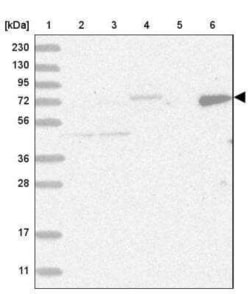 LIM Kinase 1 Antibody, Novus Biologicals:Antibodies:Primary Antibodies