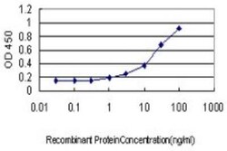 Novus Biologicals LIM domain only 3 Antibody (1A8), Novus Biologicals 0.1 mg, Unconjugated | Buy Online | Novus Biologicals&trade; | Fisher Scientific