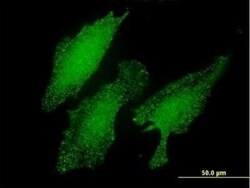 LIM domain only 3 Antibody (2H2), Novus Biologicals 0.1 mg | Buy Online | Novus Biologicals | Fisher Scientific
