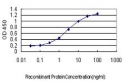 LIM domain only 3 Antibody (2H2), Novus Biologicals 0.1 mg | Buy Online | Novus Biologicals | Fisher Scientific