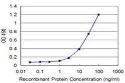 LIM domain only 3 Antibody (4A8), Novus Biologicals 0.1 mg | Buy Online | Novus Biologicals | Fisher Scientific
