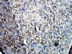 LIM kinase 2 Antibody, Novus Biologicals 100 &mu;g | Buy Online | Novus Biologicals | Fisher Scientific