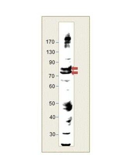 LIM kinase 2 Antibody, Novus Biologicals 100 &mu;g | Buy Online | Novus Biologicals | Fisher Scientific