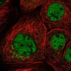 LIM1 Rabbit anti-Human, Polyclonal, Novus Biologicals:Antibodies:Primary