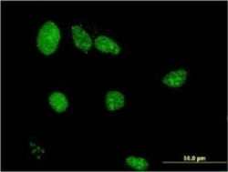 LIMD1 Antibody (2G5), Novus Biologicals 0.1 mg, Unconjugated:Antibodies,